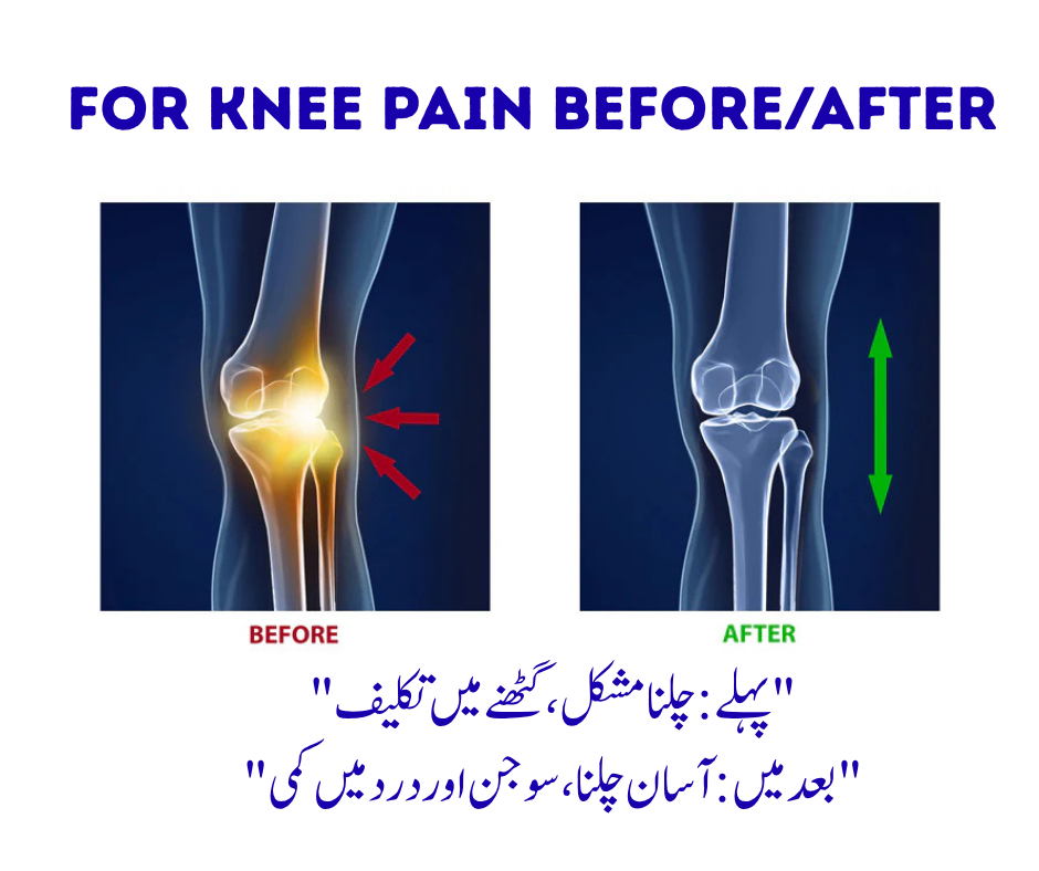 JointX Joint Pain Relief Oil